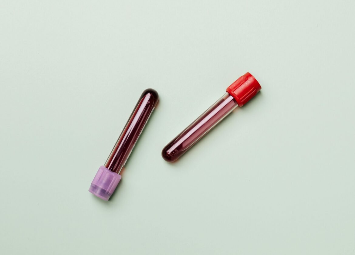 Muestras de sangre en tubos de ensayo sobre fondo ligero, ideal para temas médicos y de laboratorio.
