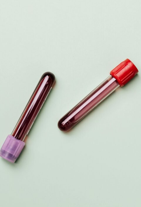 Blood Samples in Test Tubes On Light Background, Ideal for Medical and Laboratory Themes.