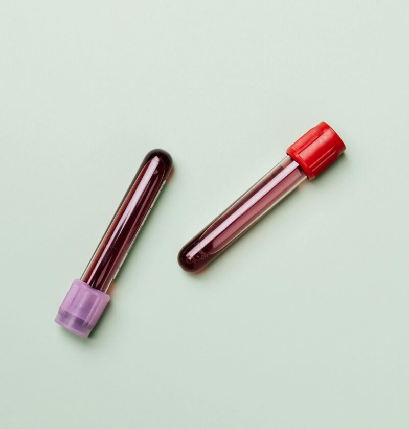 Blood Samples in Test Tubes On Light Background, Ideal for Medical and Laboratory Themes.
